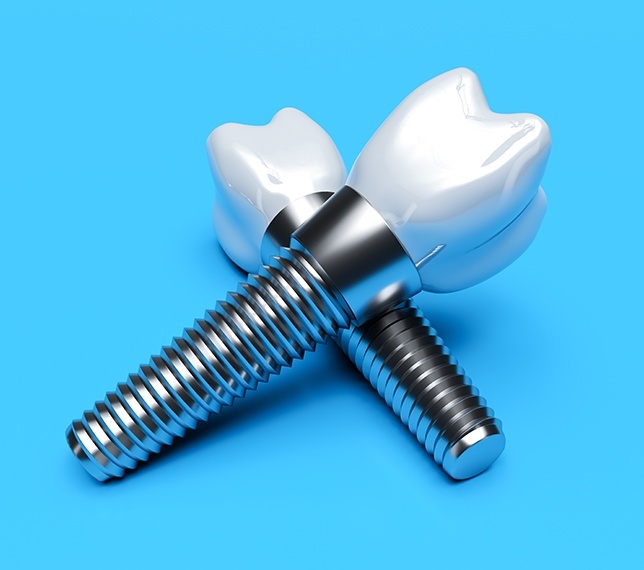 Two animated dental implant supported dental crowns
