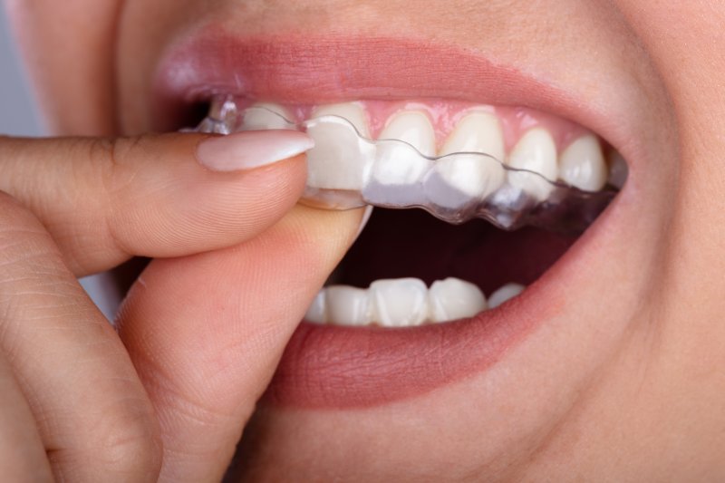 person removing clear aligners in Edmond